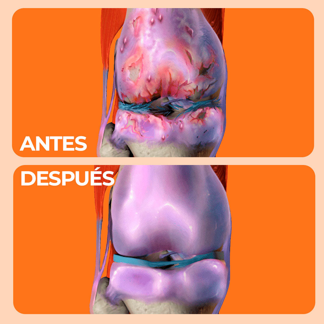 Auren™ Salud Articular