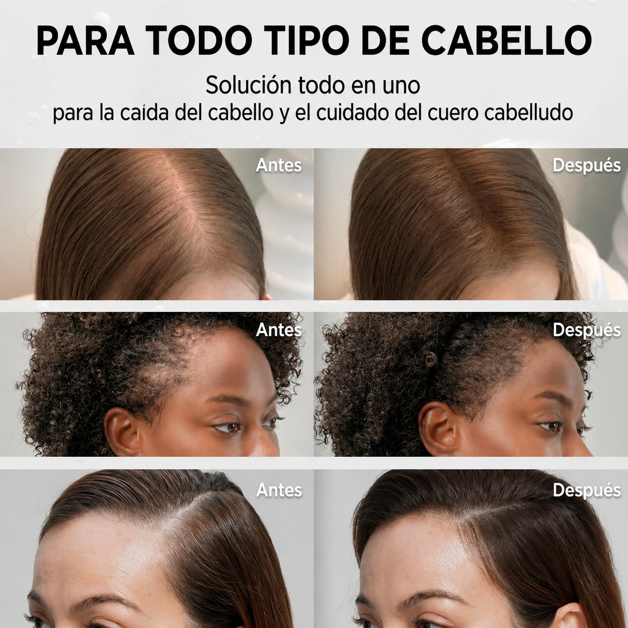 Serum Coreano Crecimiento de Cabello